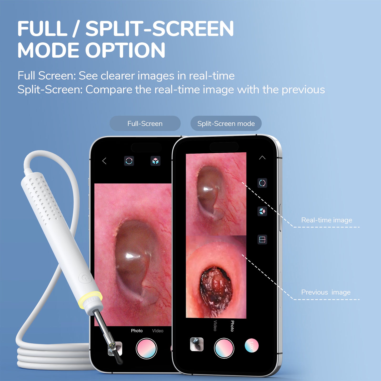 USB Otoscope Camera with Ear Wax Removal