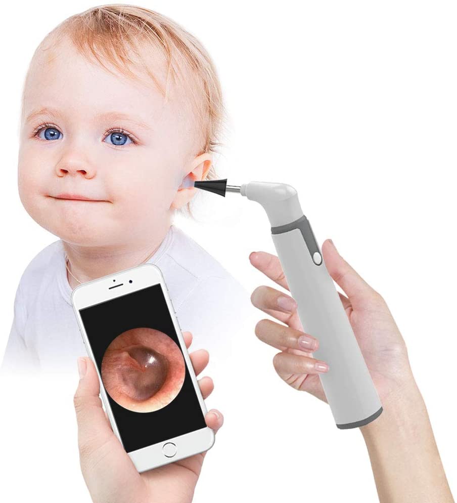 5-in-1 Multipurpose Wireless Smart Otoscope & Ear Cleaning Camera